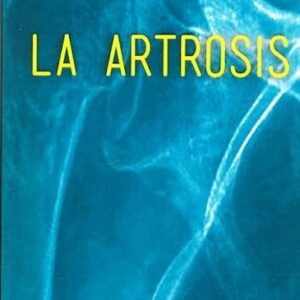 Portada de La artrosis.